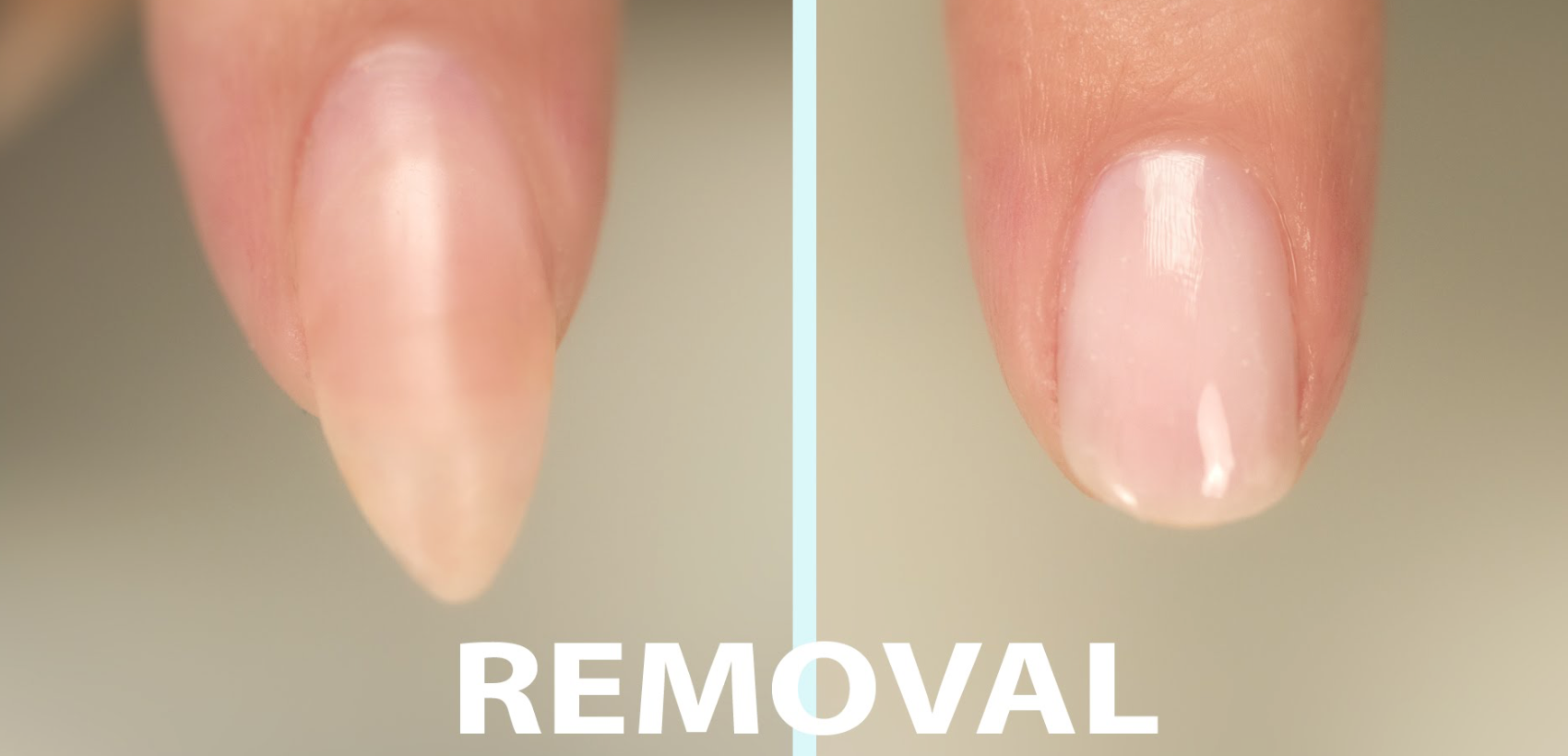 false nail removal