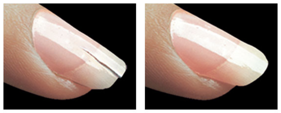 fingernail repair