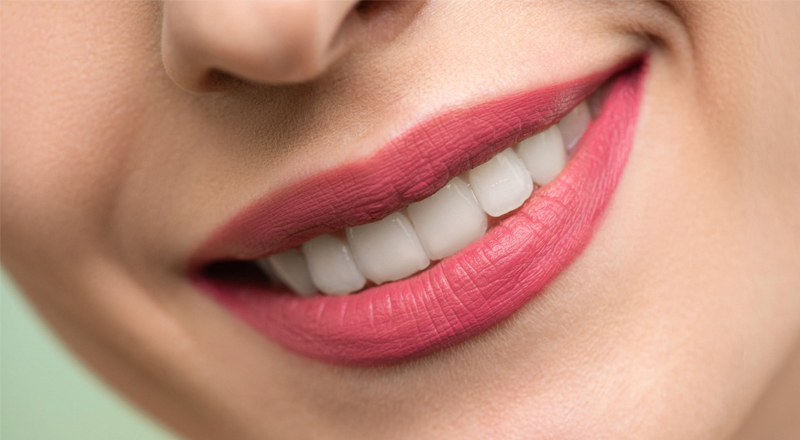 teeth whitening in calgary